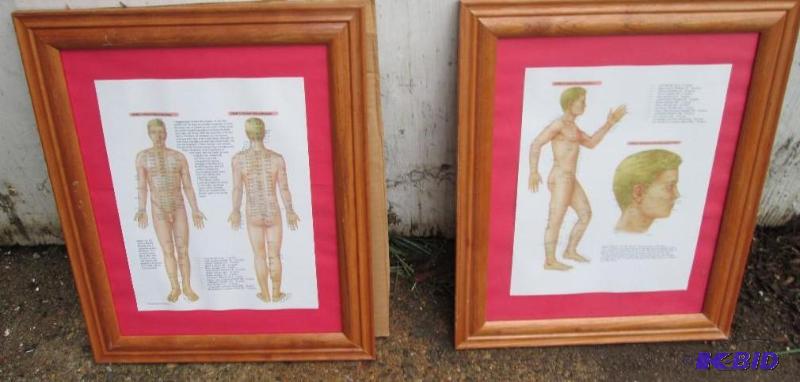 2 framed prints of the accupunture points...