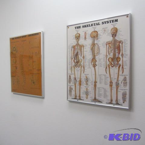 Framed Charts